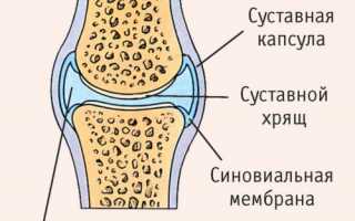 Дона — лекарство от артроза. Таблетки Дона