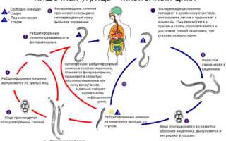 Заболевание стронгилоидоз