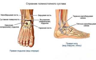 Признаки и симптомы вывиха голеностопного сустава