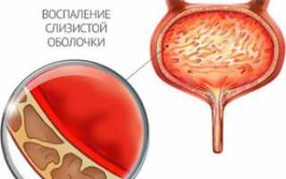 Зверобой от гастрита