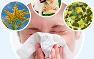 Лечение аллергии современными препаратами и народными средствами