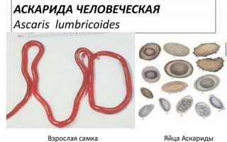 Морфология круглых и плоских паразитических червей — отличие видов