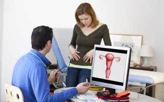 Какие патологии эндометрия бывают у женщин