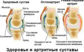 Диклофенак мазь: описание, аналоги, противопоказания