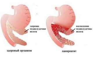 Гастрит у ребенка