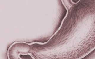 Виды и лечение эритематозного гастрита