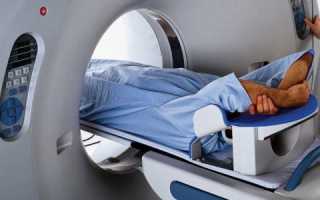Компьютерная томография кишечника и желудка