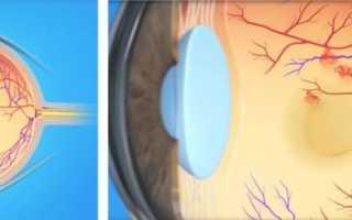 Немного о анатомии: сетчатка глаза, ее строение и функции