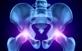 Рентген тазобедренного сустава: показания и противопоказания