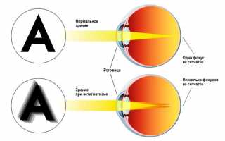 Интересная офтальмология: как видит человек с астигматизмом