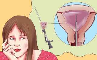 Как проводится гистероскопия матки и для чего она нужна