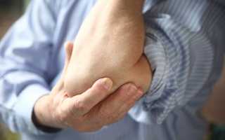 Боль в локтевом суставе: чем лечить