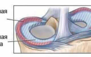 Разрыв мениска: признаки, причины, последствия