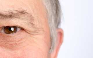 Консультация офтальмолога: как лечить катаракту в пожилом возрасте