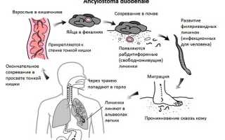 Все признаки и симптомы анкилостомоза у человека
