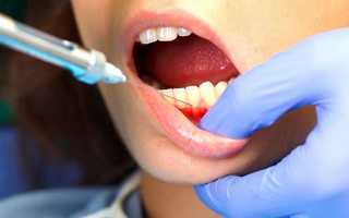 Аллергия на анестезию в стоматологии: симптомы и лечение