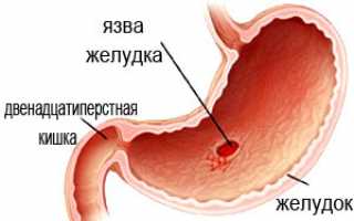 Гастрит и огурцы