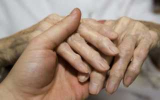 Симптомы и диагностика артроза кисти рук