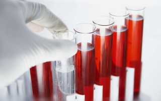 Виды анализов крови на паразитов
