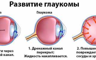 Ежегодная диспансеризация: ранняя диагностика глаукомы