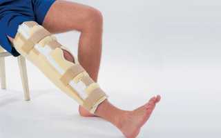 Вывих коленного сустава: что делать и как лечить