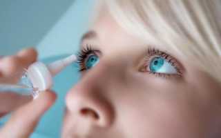 Причины, по которым глаза красные и чешутся, когда симптомы несут опасность